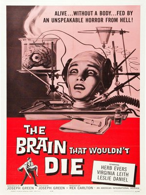 cover image of The Brain That Wouldn't Die